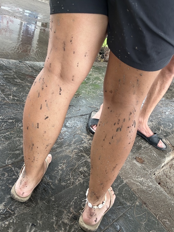Nos jambes et shorts pendant 2 jours