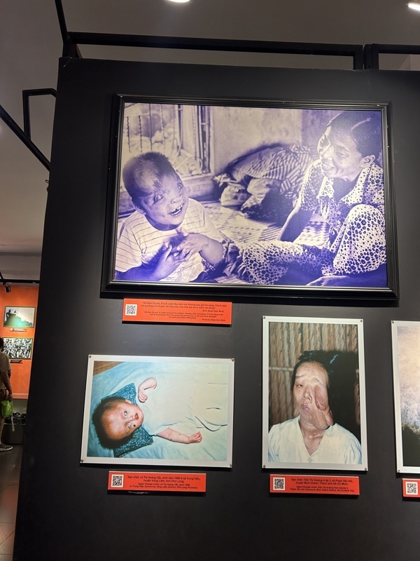 Malformations dues à l’agent orange